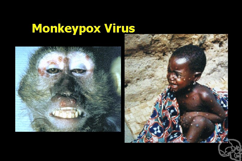 Monkeypox Virus 