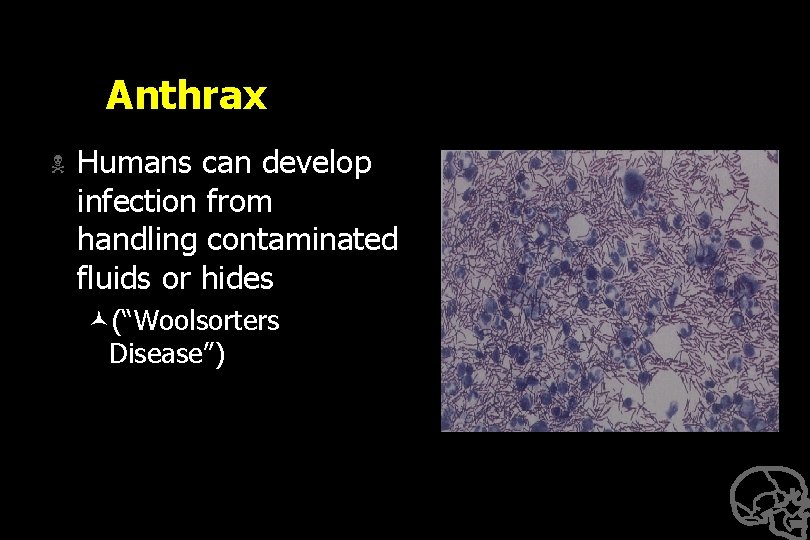 Anthrax N Humans can develop infection from handling contaminated fluids or hides ©(“Woolsorters Disease”)