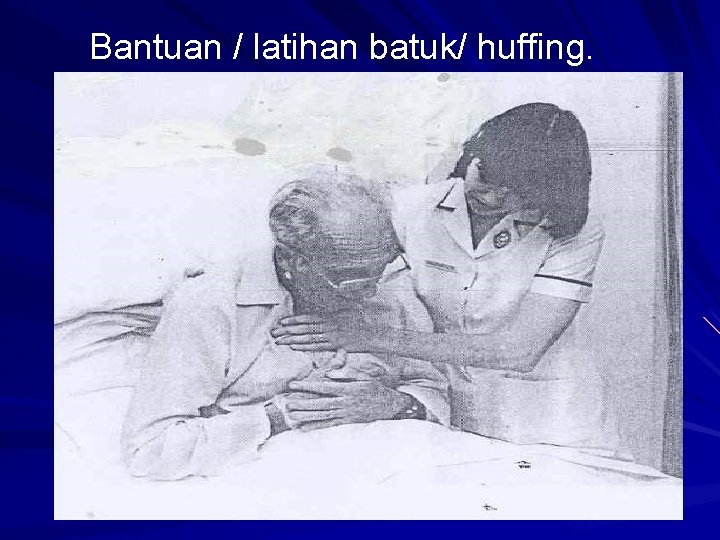 Bantuan / latihan batuk/ huffing. 