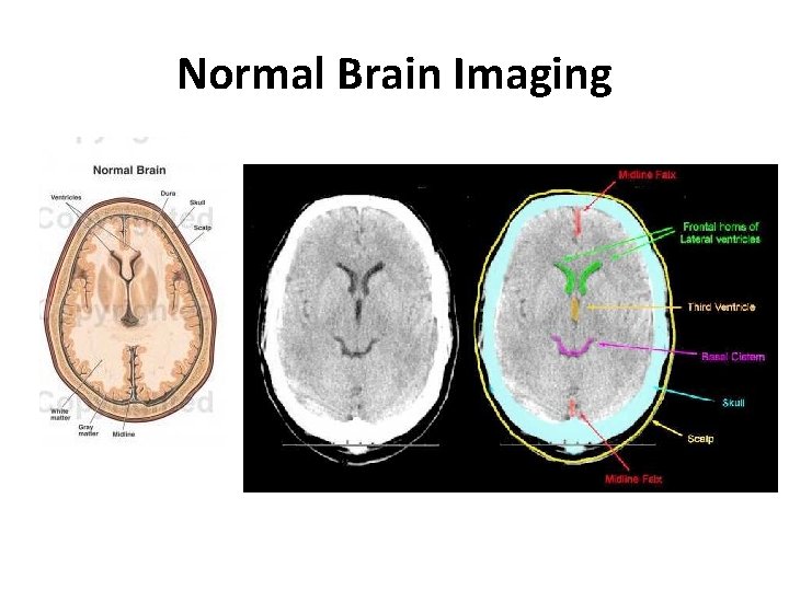 Normal Brain Imaging 