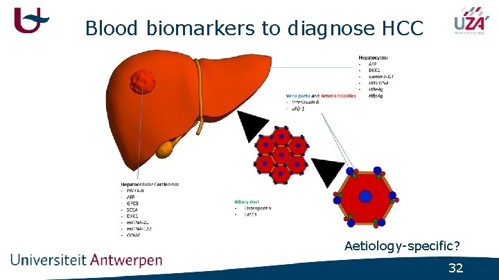 Blood biomarkers to diagnose HCC Aetiology-specific? 32 