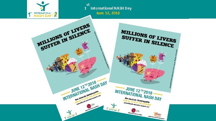 June 12, 2018 – 1 st International NASH st 1 International NASH Day June