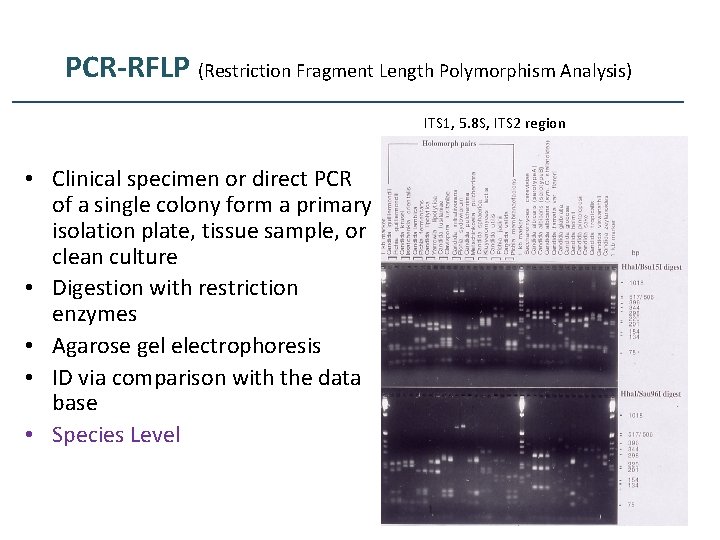 PCR-RFLP (Restriction Fragment Length Polymorphism Analysis) ITS 1, 5. 8 S, ITS 2 region