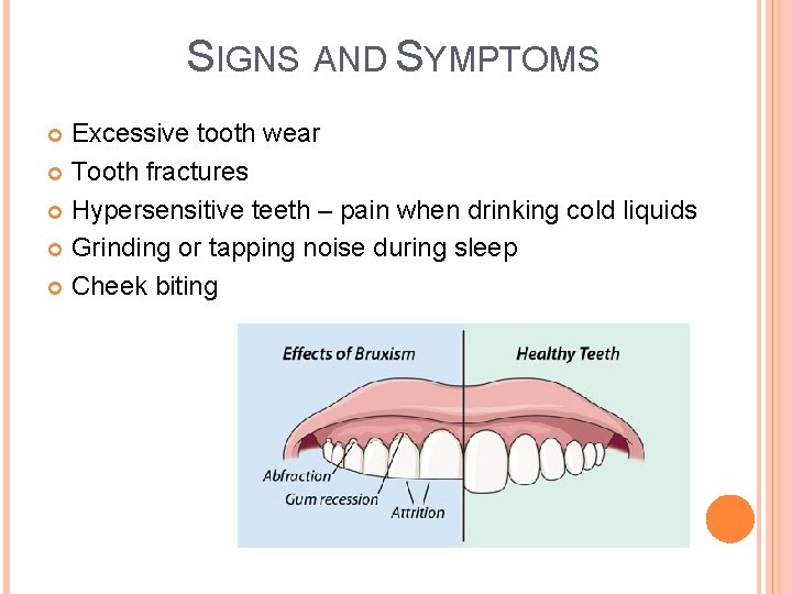 SIGNS AND SYMPTOMS Excessive tooth wear Tooth fractures Hypersensitive teeth – pain when drinking