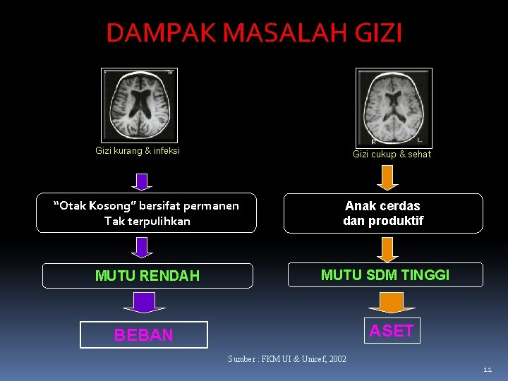 DAMPAK MASALAH GIZI Gizi kurang & infeksi Gizi cukup & sehat “Otak Kosong” bersifat