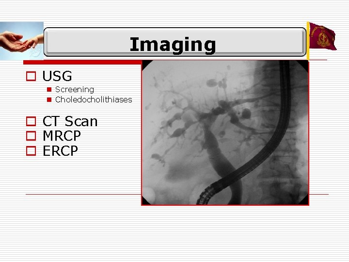 Imaging o USG n Screening n Choledocholithiases o CT Scan o MRCP o ERCP