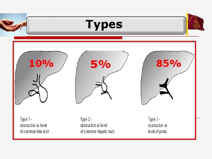 Types 10% 5% 85% 