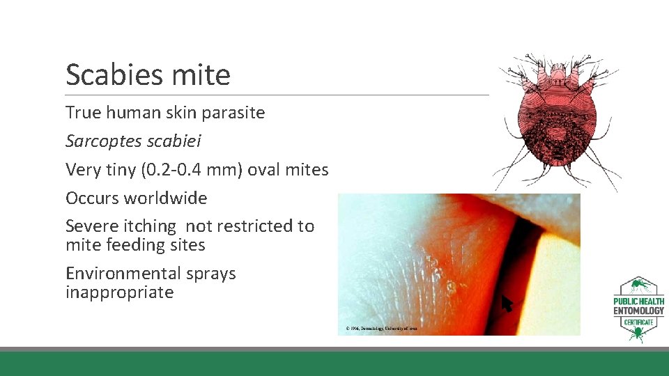 Scabies mite True human skin parasite Sarcoptes scabiei Very tiny (0. 2 -0. 4