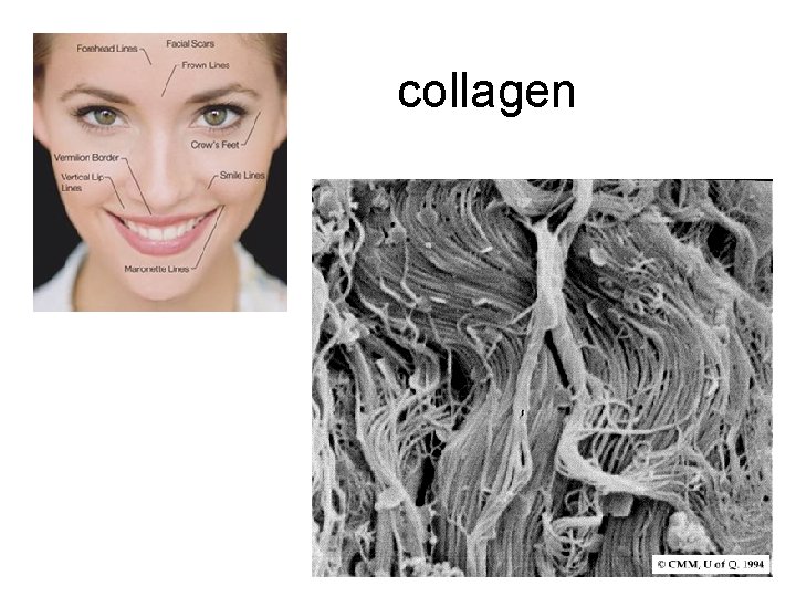 collagen 