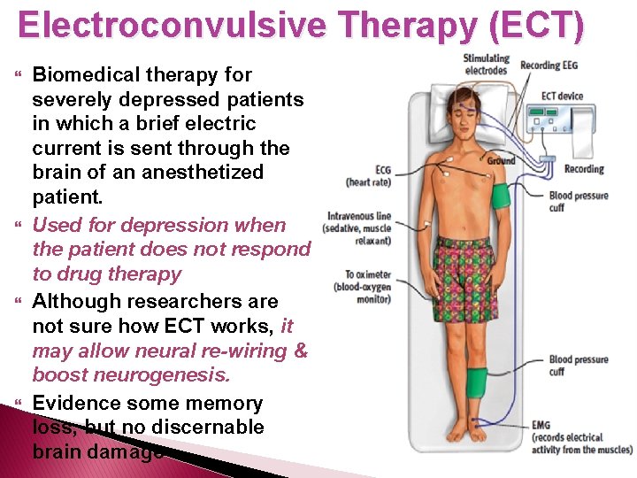 Electroconvulsive Therapy (ECT) Biomedical therapy for severely depressed patients in which a brief electric