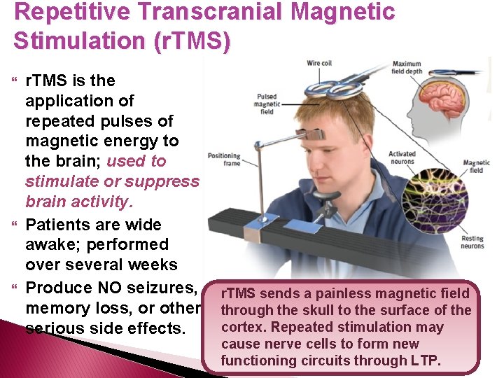 Repetitive Transcranial Magnetic Stimulation (r. TMS) r. TMS is the application of repeated pulses