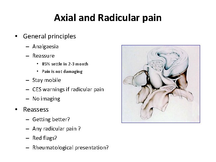 Axial and Radicular pain • General principles – Analgaesia – Reassure • 85% settle