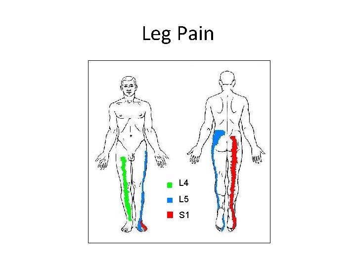 Leg Pain L 4 L 5 S 1 