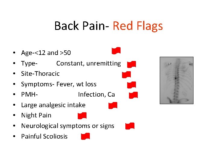 Back Pain- Red Flags • • • Age-<12 and >50 Type. Constant, unremitting Site-Thoracic
