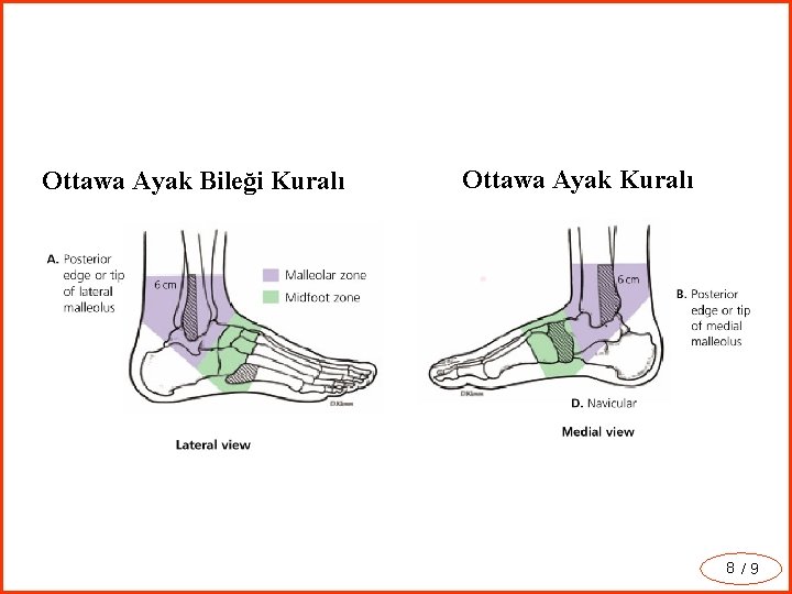 Ottawa Ayak Bileği Kuralı Ottawa Ayak Kuralı 8 /9 