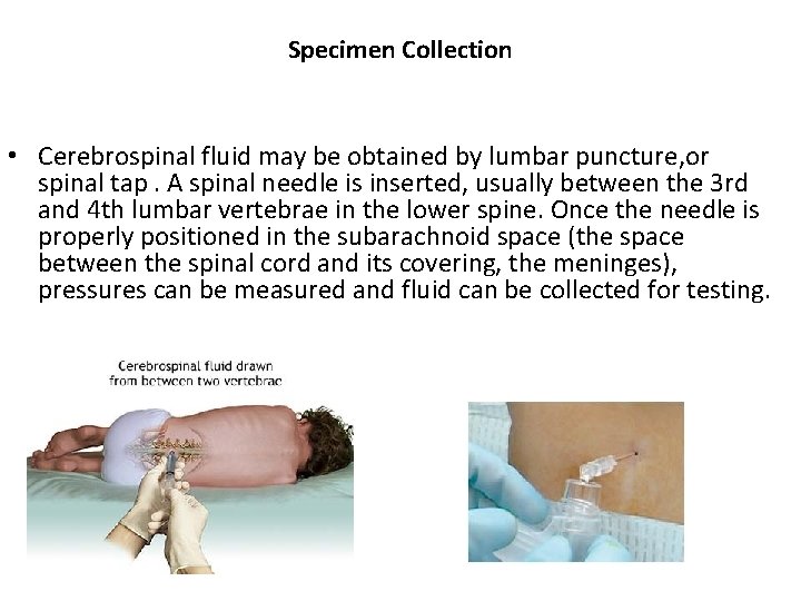 Specimen Collection • Cerebrospinal fluid may be obtained by lumbar puncture, or spinal tap.