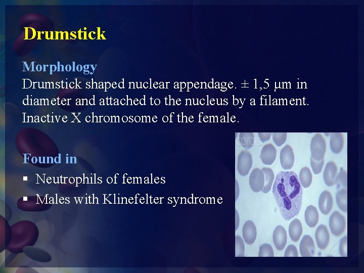 Drumstick Morphology Drumstick shaped nuclear appendage. ± 1, 5 µm in diameter and attached