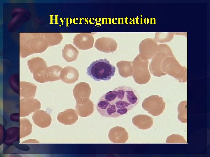 Hypersegmentation 