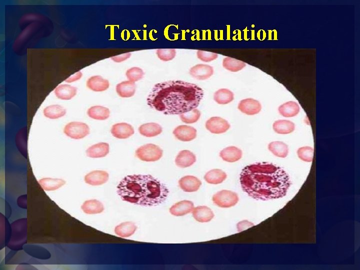 Toxic Granulation 