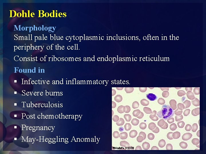 Dohle Bodies Morphology Small pale blue cytoplasmic inclusions, often in the periphery of the