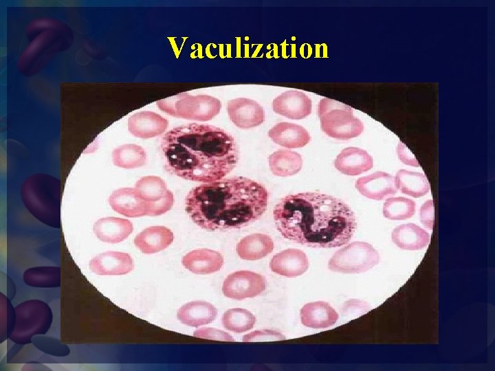 Vaculization 