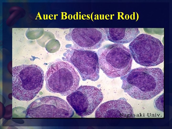 Auer Bodies(auer Rod) 