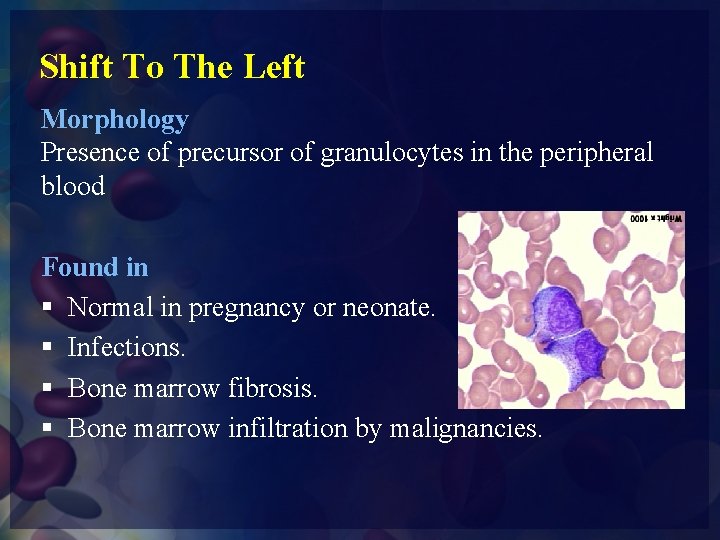 Shift To The Left Morphology Presence of precursor of granulocytes in the peripheral blood
