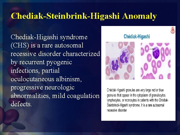 Chediak-Steinbrink-Higashi Anomaly Chediak-Higashi syndrome (CHS) is a rare autosomal recessive disorder characterized by recurrent