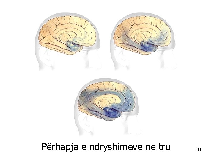 Përhapja e ndryshimeve ne tru 84 