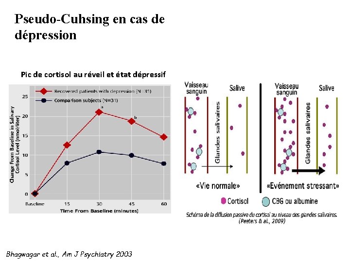 Pseudo-Cuhsing en cas de dépression Pic de cortisol au réveil et état dépressif Bhagwagar