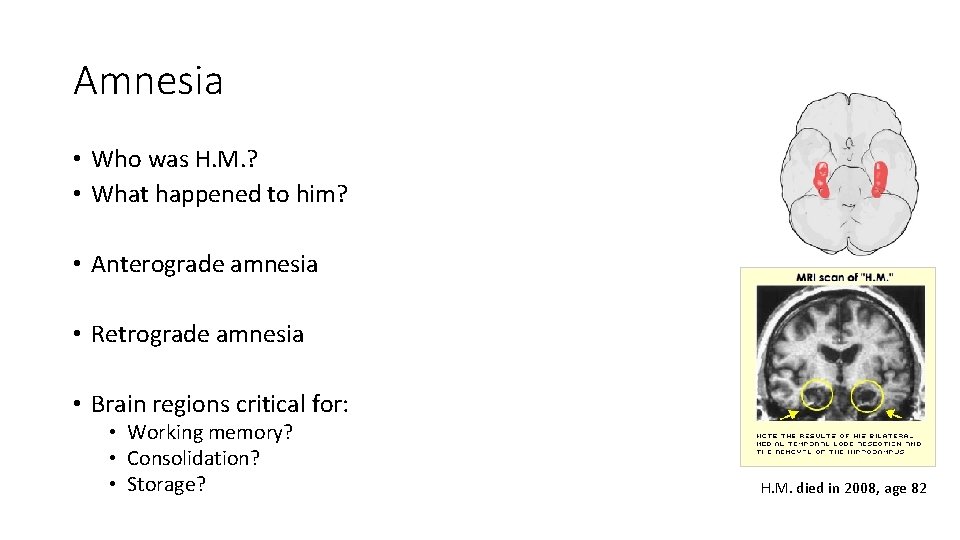 Amnesia • Who was H. M. ? • What happened to him? • Anterograde