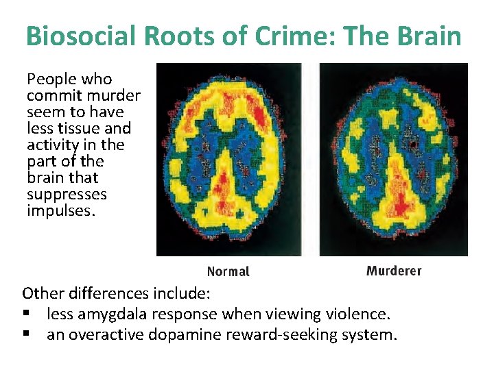 Biosocial Roots of Crime: The Brain People who commit murder seem to have less