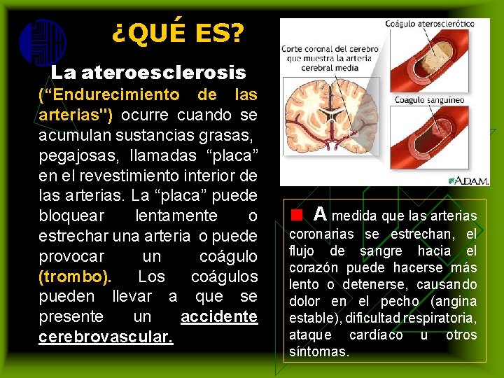 ¿QUÉ ES? La ateroesclerosis (“Endurecimiento de las arterias") ocurre cuando se acumulan sustancias grasas,