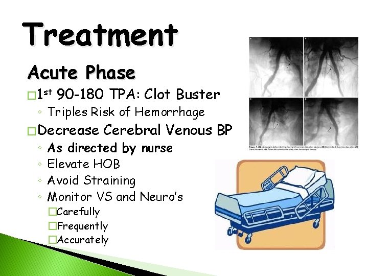 Treatment Acute Phase � 1 st 90 -180 TPA: Clot Buster ◦ Triples Risk