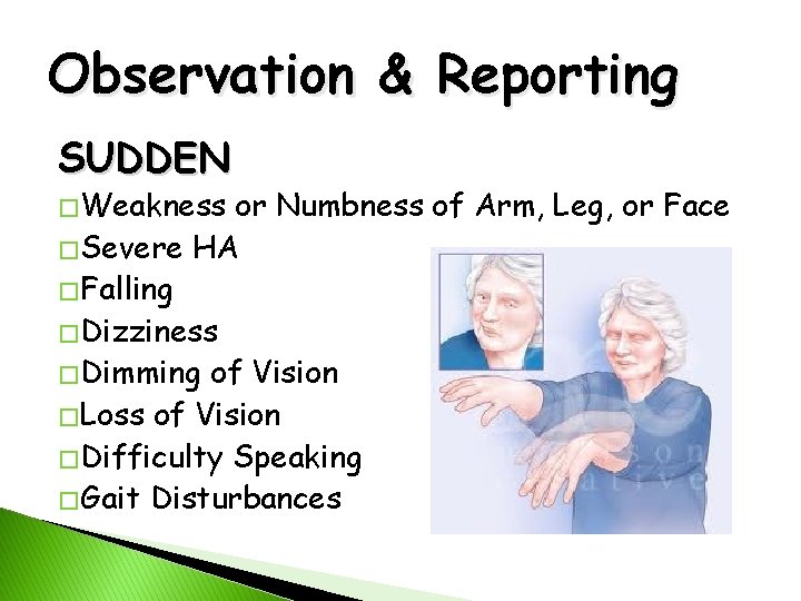 Observation & Reporting SUDDEN � Weakness or Numbness of Arm, Leg, or Face �