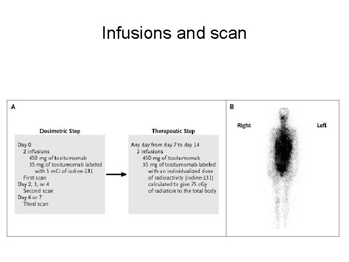Infusions and scan 