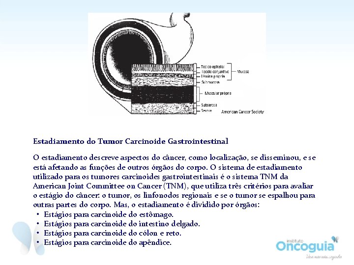 Estadiamento do Tumor Carcinoide Gastrointestinal O estadiamento descreve aspectos do câncer, como localização, se