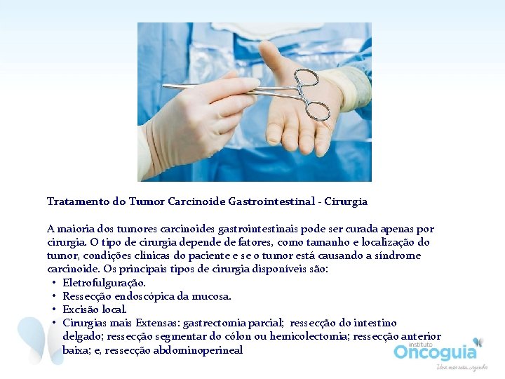 Tratamento do Tumor Carcinoide Gastrointestinal - Cirurgia A maioria dos tumores carcinoides gastrointestinais pode