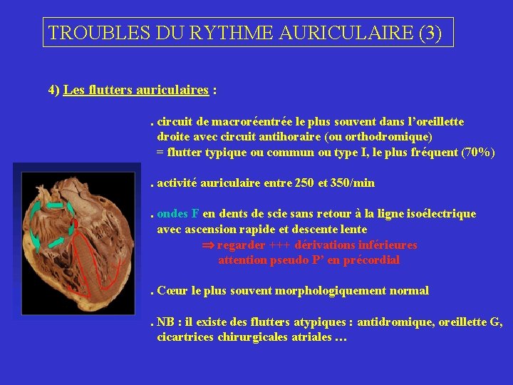 TROUBLES DU RYTHME AURICULAIRE (3) 4) Les flutters auriculaires : . circuit de macroréentrée