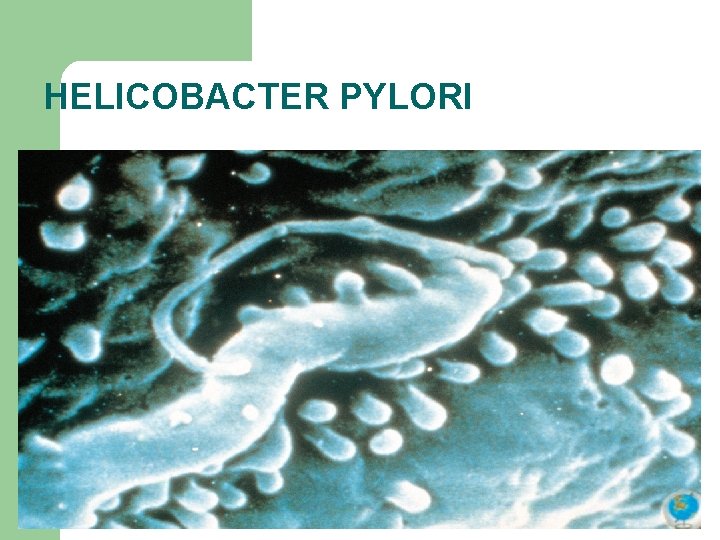 HELICOBACTER PYLORI 