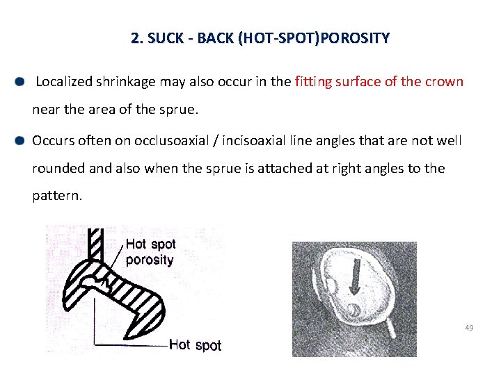 2. SUCK - BACK (HOT-SPOT)POROSITY Localized shrinkage may also occur in the fitting surface