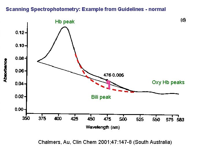 Scanning Spectrophotometry: Example from Guidelines - normal Hb peak Oxy Hb peaks Bili peak