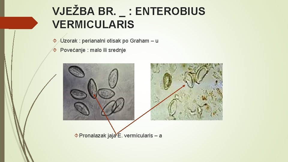 VJEŽBA BR. _ : ENTEROBIUS VERMICULARIS Uzorak : perianalni otisak po Graham – u