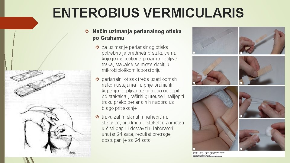 ENTEROBIUS VERMICULARIS Način uzimanja perianalnog otiska po Grahamu za uzimanje perianalnog otiska potrebno je