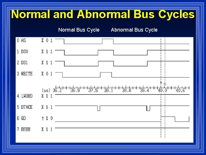 Normal and Abnormal Bus Cycles Normal Bus Cycle Abnormal Bus Cycle 
