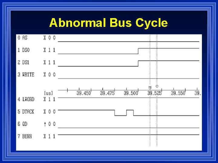 Abnormal Bus Cycle 