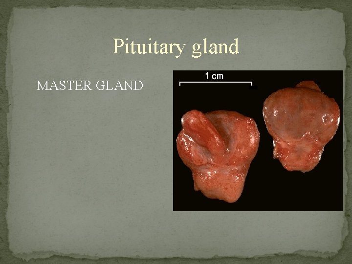 Pituitary gland MASTER GLAND 