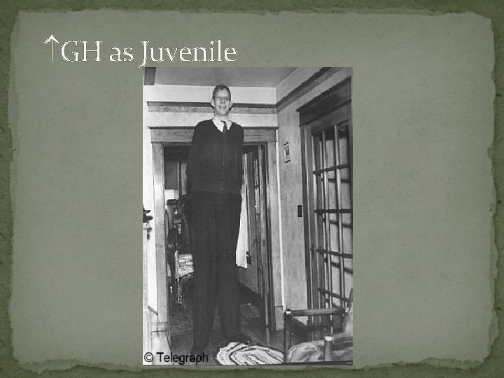  GH as Juvenile 