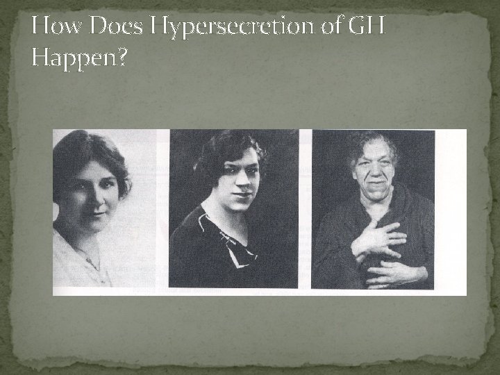 How Does Hypersecretion of GH Happen? 