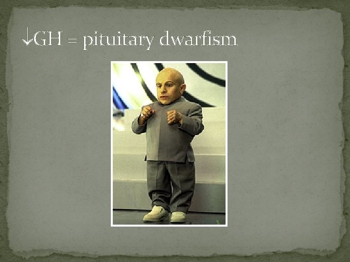  GH = pituitary dwarfism 